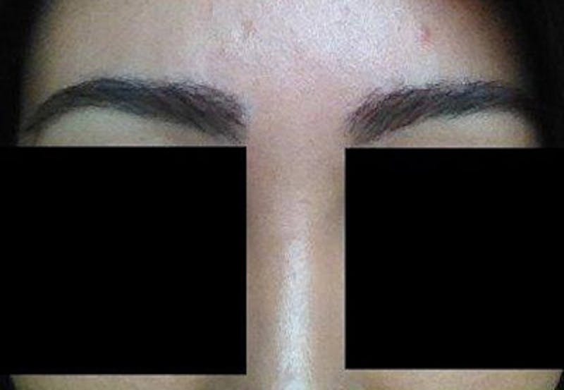 Special Cases Before & After Gallery - Patient 362558 - Image 2