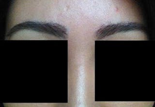 Special Cases Before & After Gallery - Patient 303383 - Image 2