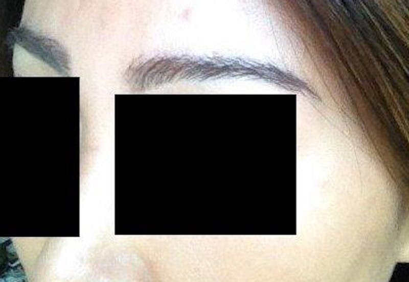 Special Cases Before & After Gallery - Patient 362558 - Image 4