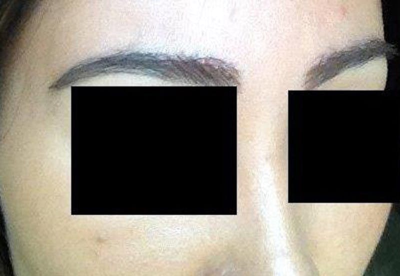 Special Cases Before & After Gallery - Patient 362558 - Image 6