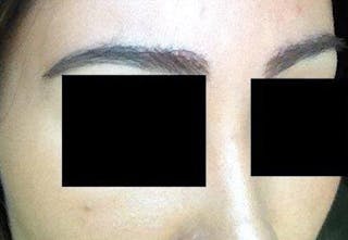 Special Cases Before & After Gallery - Patient 303383 - Image 6