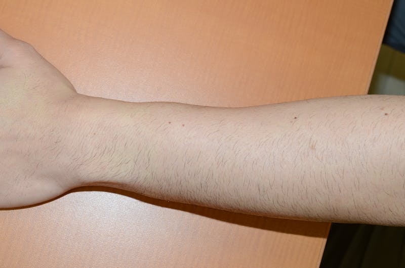 Special Cases Before & After Gallery - Patient 403316 - Image 3