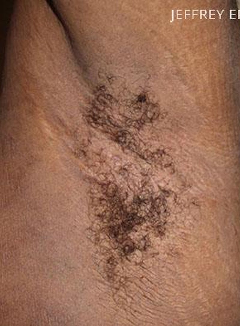 Special Cases Before & After Gallery - Patient 398443 - Image 3