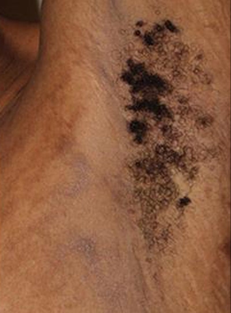 Special Cases Before & After Gallery - Patient 398443 - Image 4