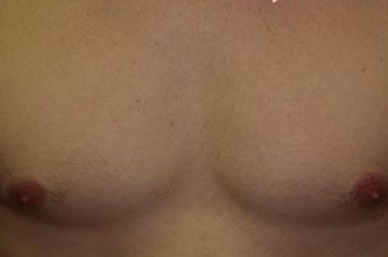 Special Cases Before & After Gallery - Patient 163262 - Image 1