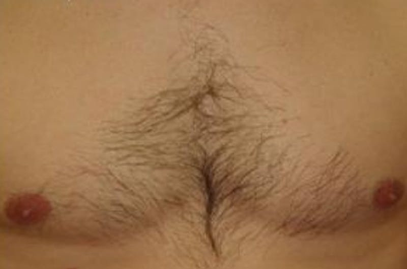 Special Cases Before & After Gallery - Patient 163262 - Image 2