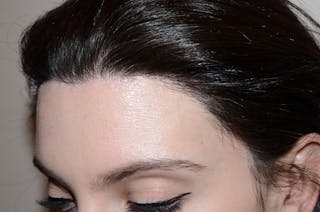 Hair Procedures for Women Before & After Gallery - Patient 346165 - Image 4