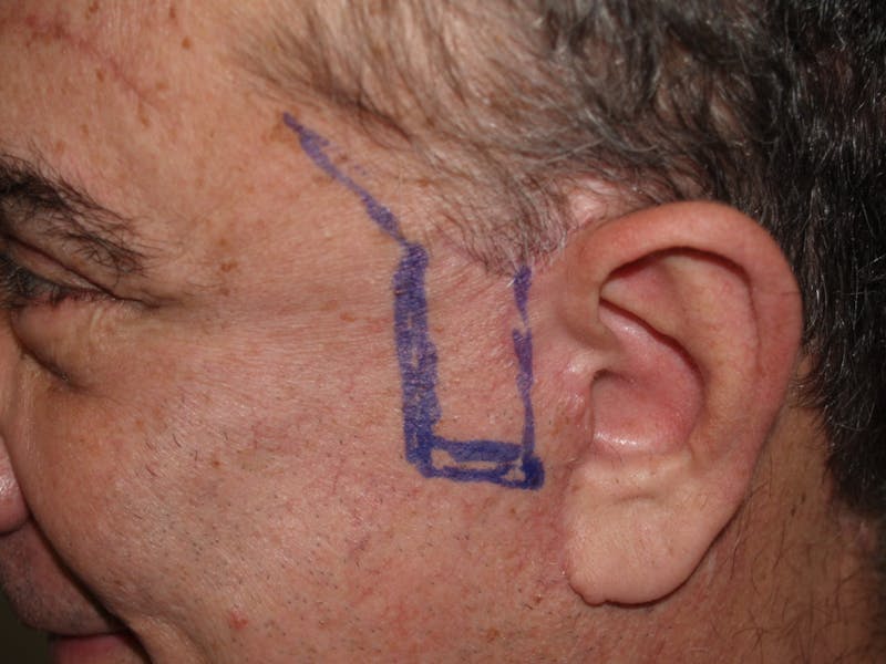 Special Cases Before & After Gallery - Patient 389414 - Image 3