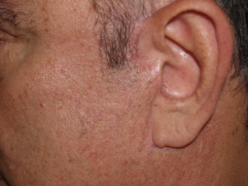 Special Cases Before & After Gallery - Patient 389414 - Image 4