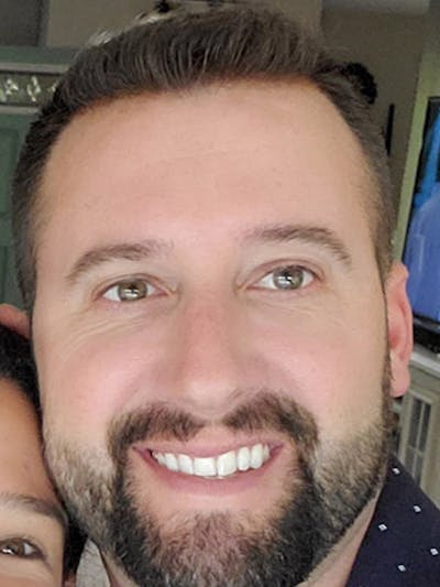 Hair Restoration for Men Before & After Gallery - Patient 651133 - Image 2