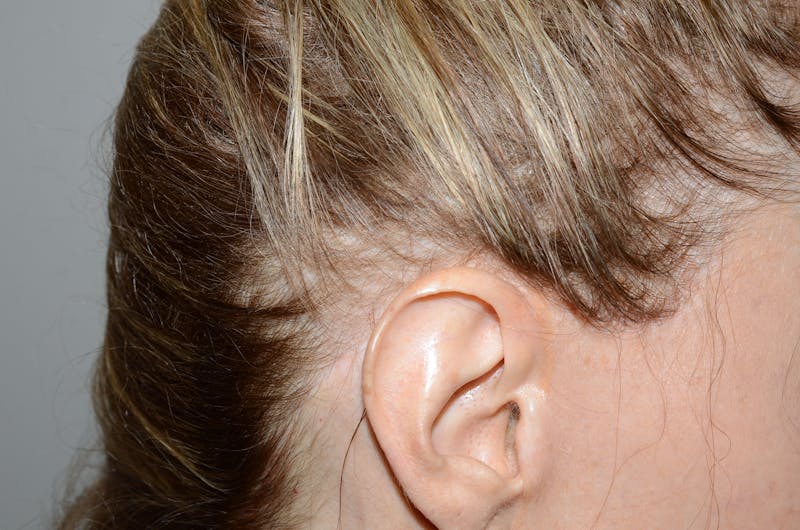 Special Cases Before & After Gallery - Patient 101485 - Image 5