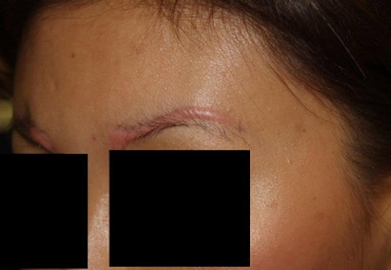 Special Cases Before & After Gallery - Patient 362558 - Image 3