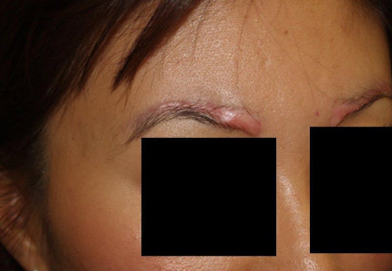 Special Cases Before & After Gallery - Patient 362558 - Image 5