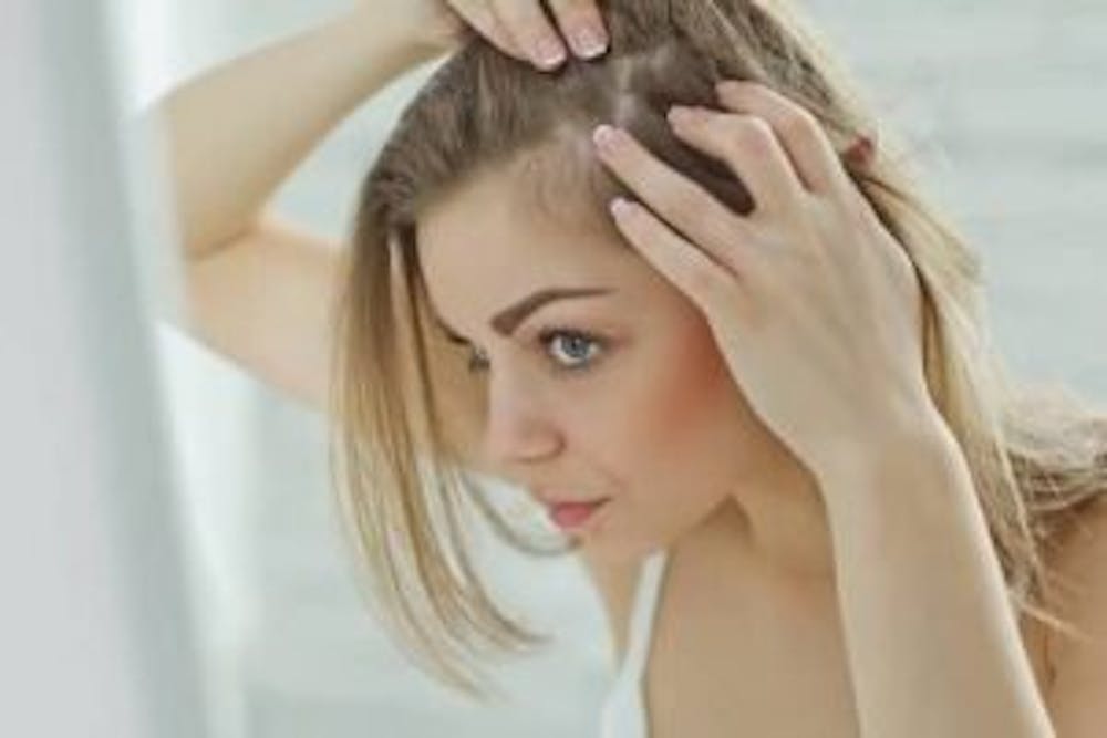Traction alopecia can occurs due to a tight hairstyle.