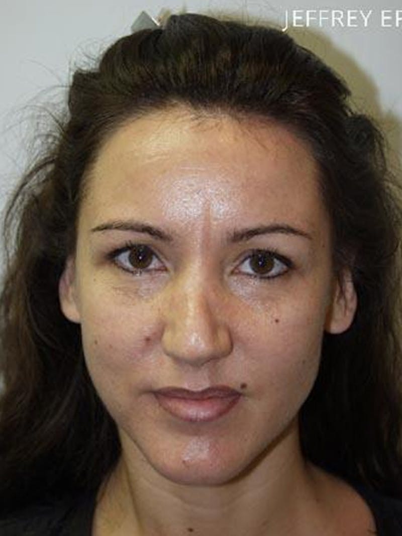 Hair Procedures for Women Before & After Gallery - Patient 239431 - Image 2