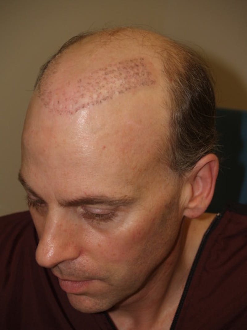 Special Cases Before & After Gallery - Patient 255551 - Image 3