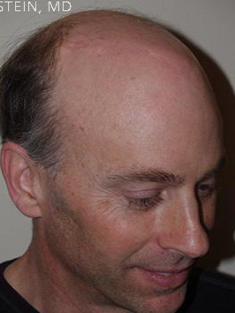 Special Cases Before & After Gallery - Patient 255551 - Image 6