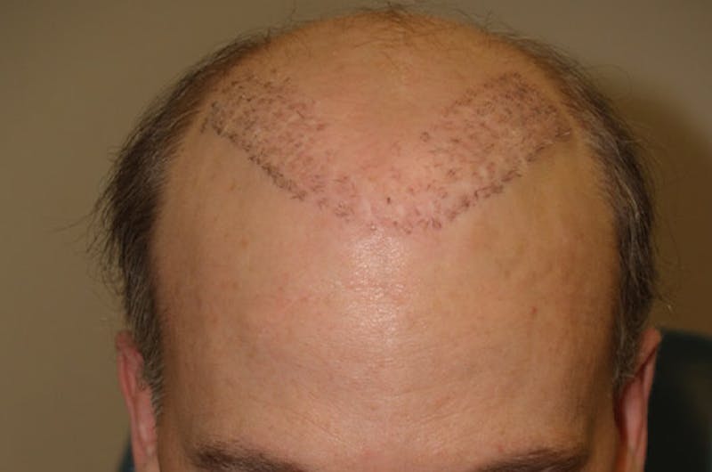 Special Cases Before & After Gallery - Patient 255551 - Image 7