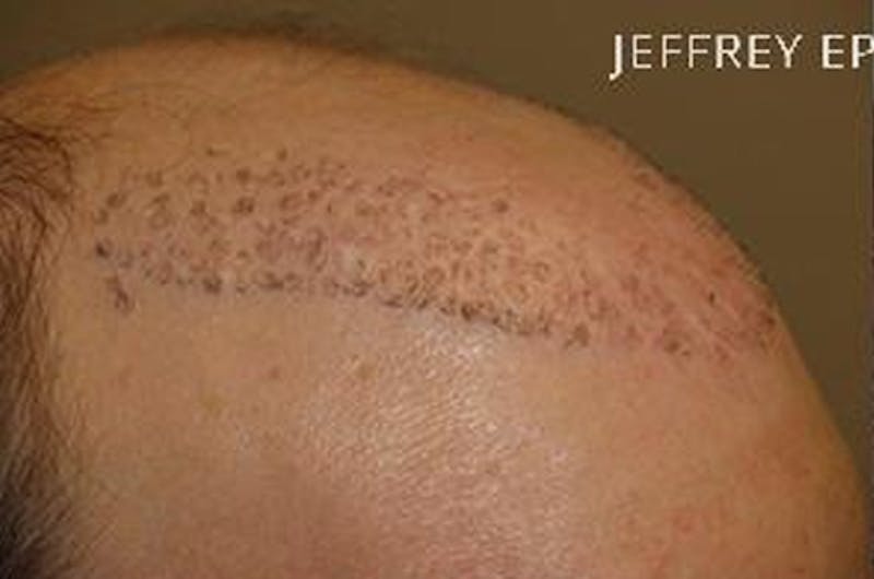Special Cases Before & After Gallery - Patient 255551 - Image 11