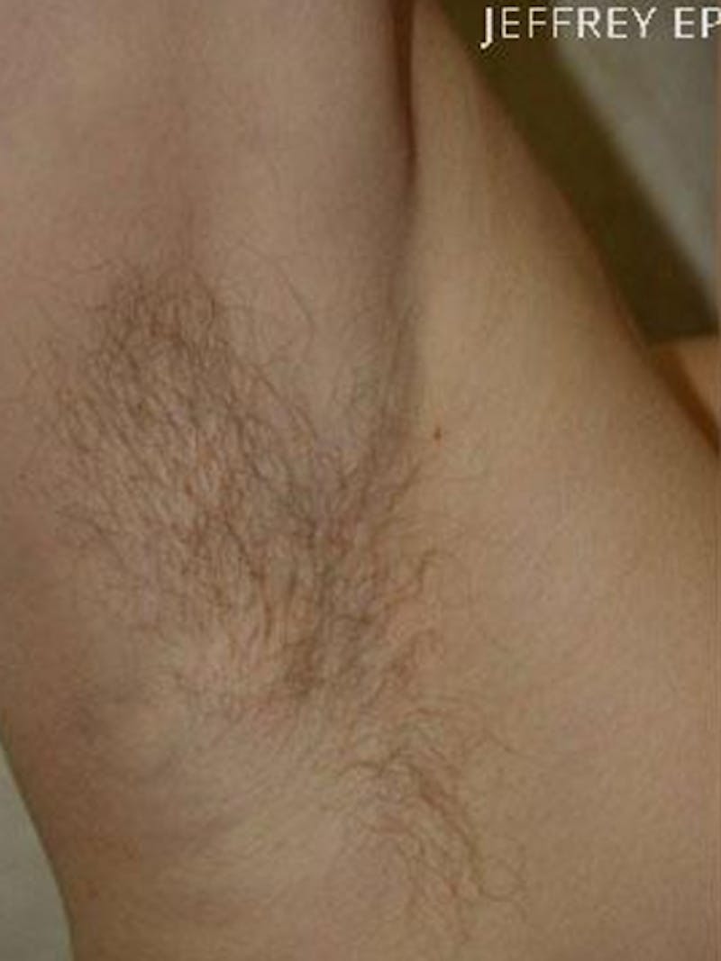 Special Cases Before & After Gallery - Patient 163262 - Image 3