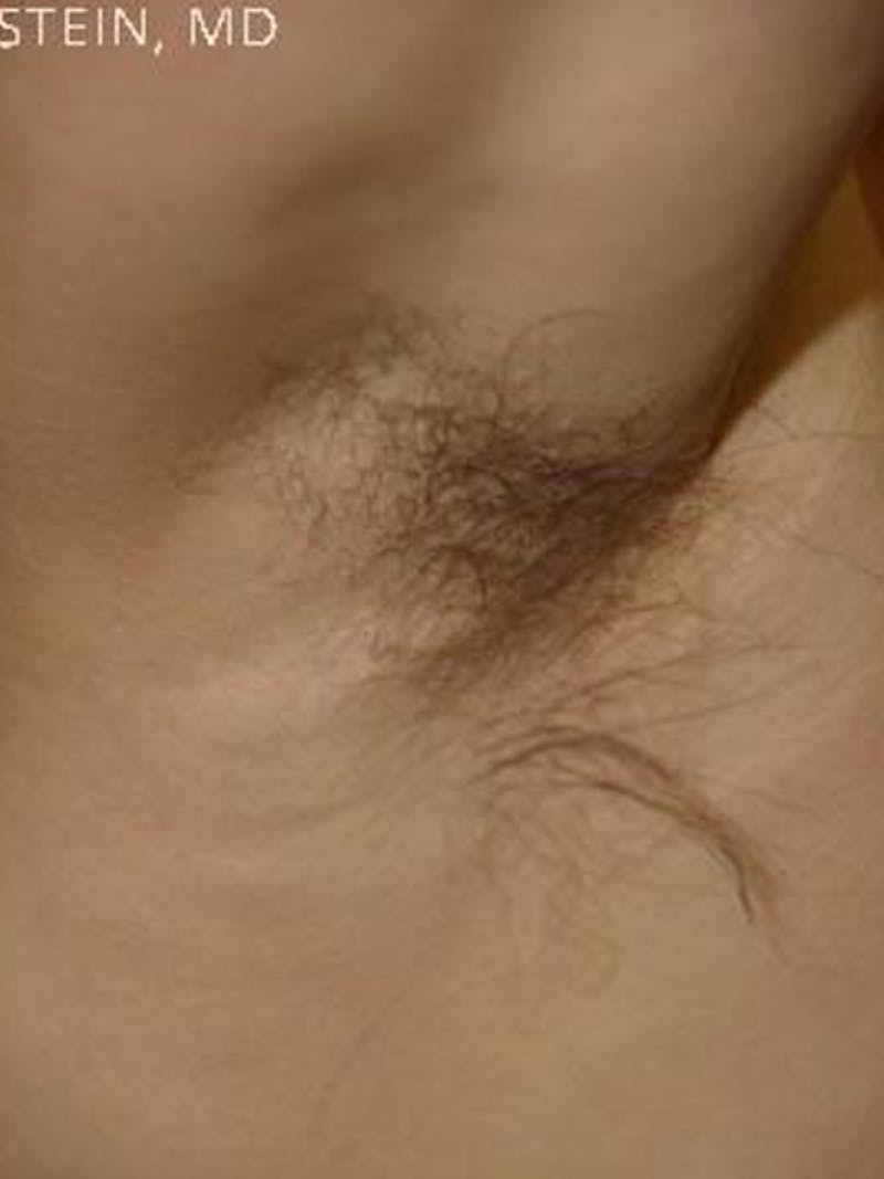 Special Cases Before & After Gallery - Patient 163262 - Image 4