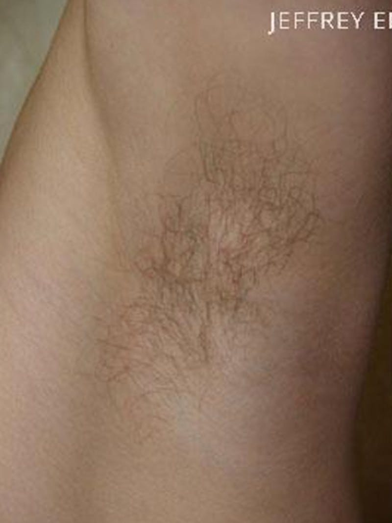 Special Cases Before & After Gallery - Patient 163262 - Image 5
