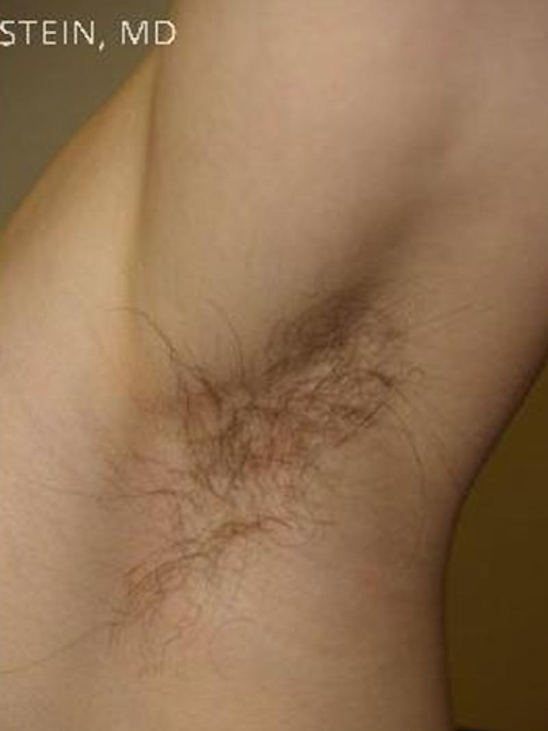 Special Cases Before & After Gallery - Patient 163262 - Image 6
