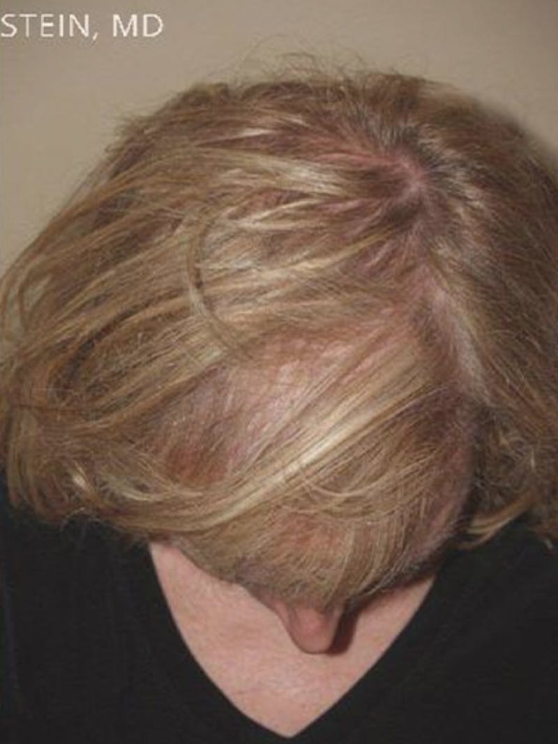 Special Cases Before & After Gallery - Patient 145966 - Image 4