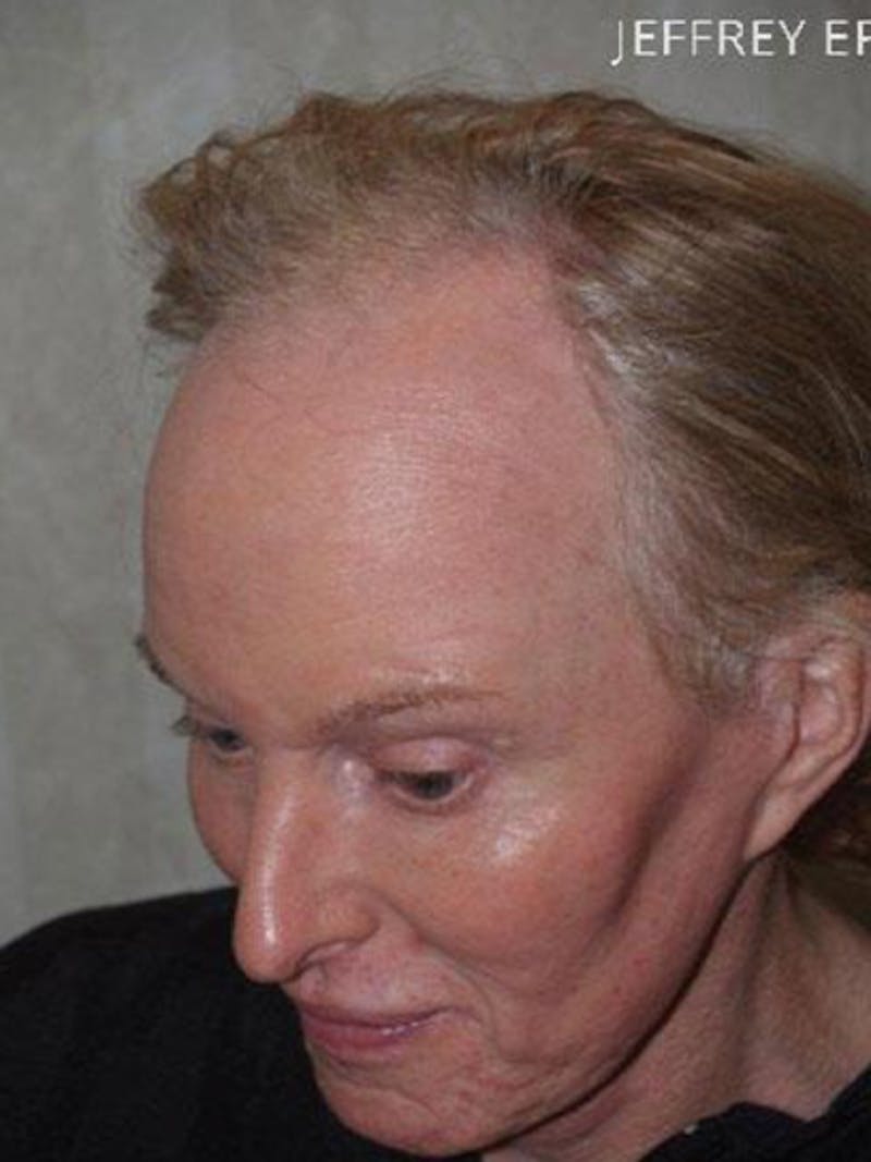 Special Cases Before & After Gallery - Patient 145966 - Image 5