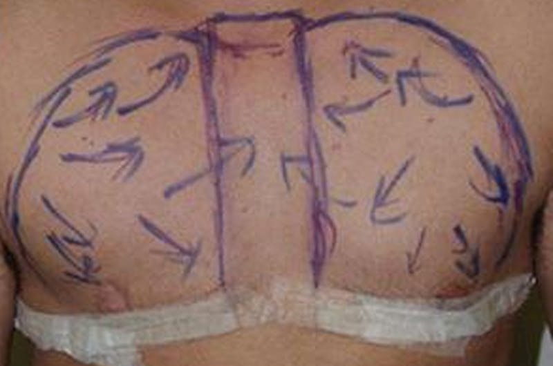 Special Cases Before & After Gallery - Patient 249709 - Image 1