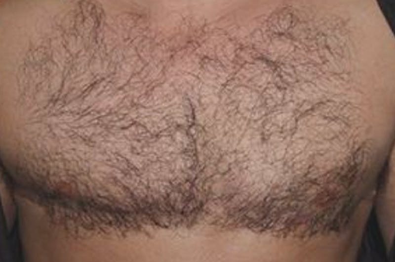 Special Cases Before & After Gallery - Patient 249709 - Image 2