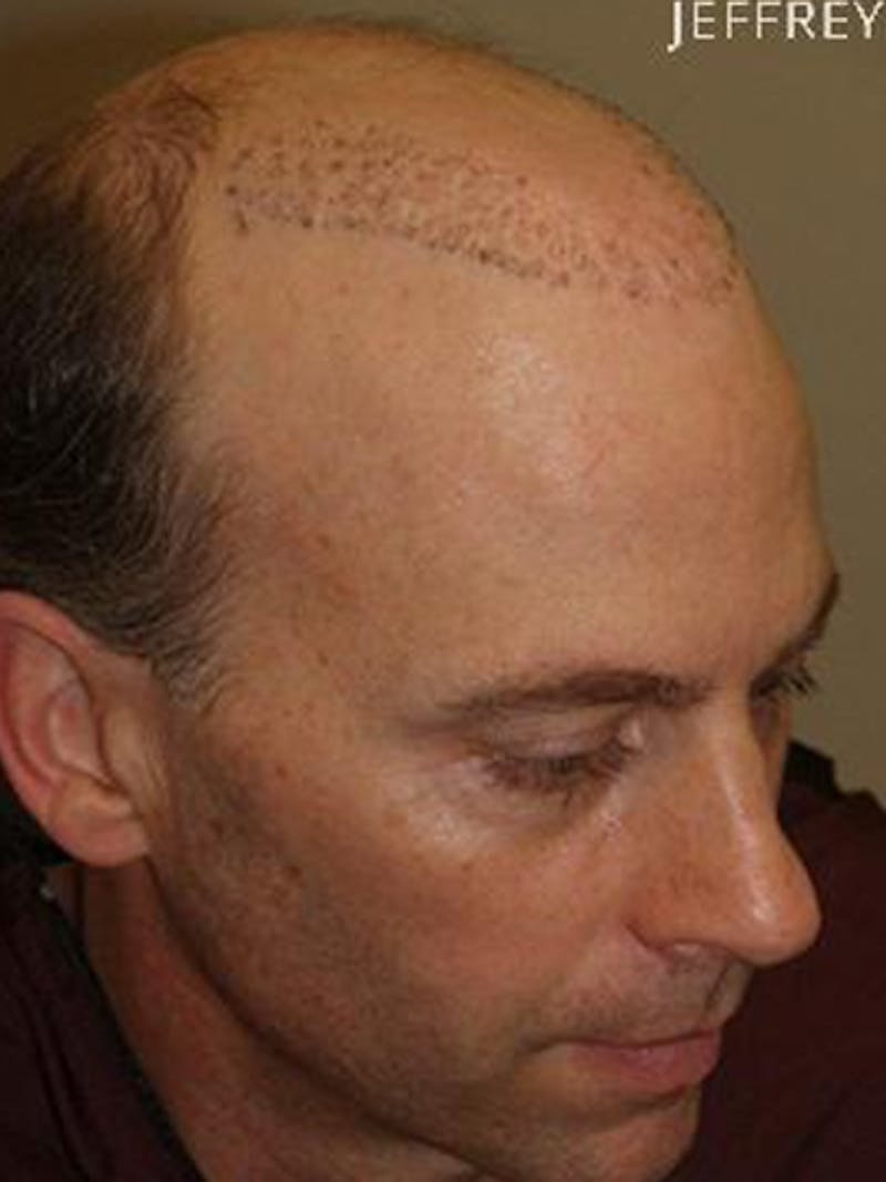 Special Cases Before & After Gallery - Patient 255551 - Image 5