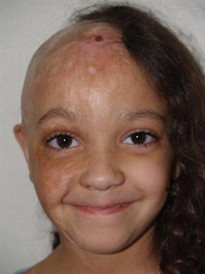 Special Cases Before & After Gallery - Patient 307019 - Image 1