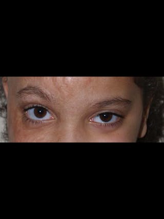 Special Cases Before & After Gallery - Patient 307019 - Image 2