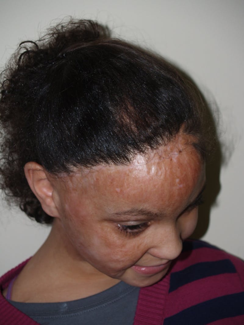 Special Cases Before & After Gallery - Patient 307019 - Image 4