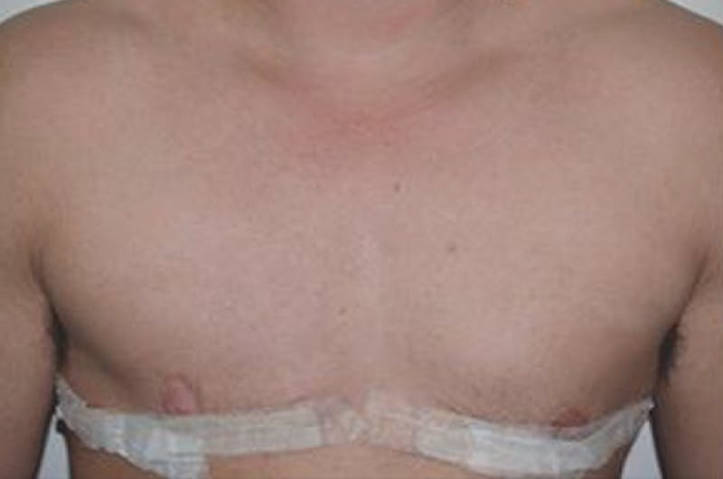 Special Cases Before & After Gallery - Patient 916719 - Image 1