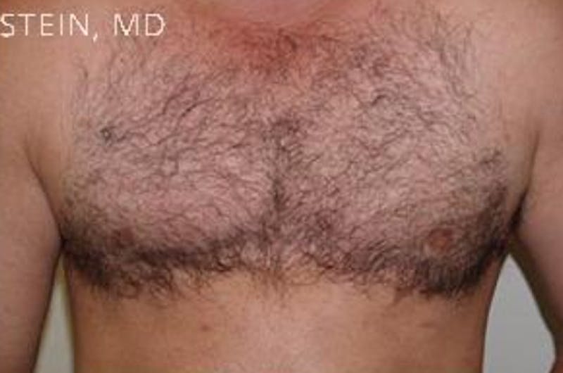Special Cases Before & After Gallery - Patient 916719 - Image 3