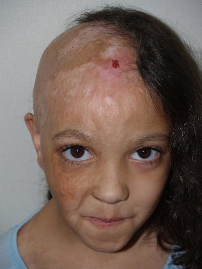 Special Cases Before & After Gallery - Patient 238642 - Image 1