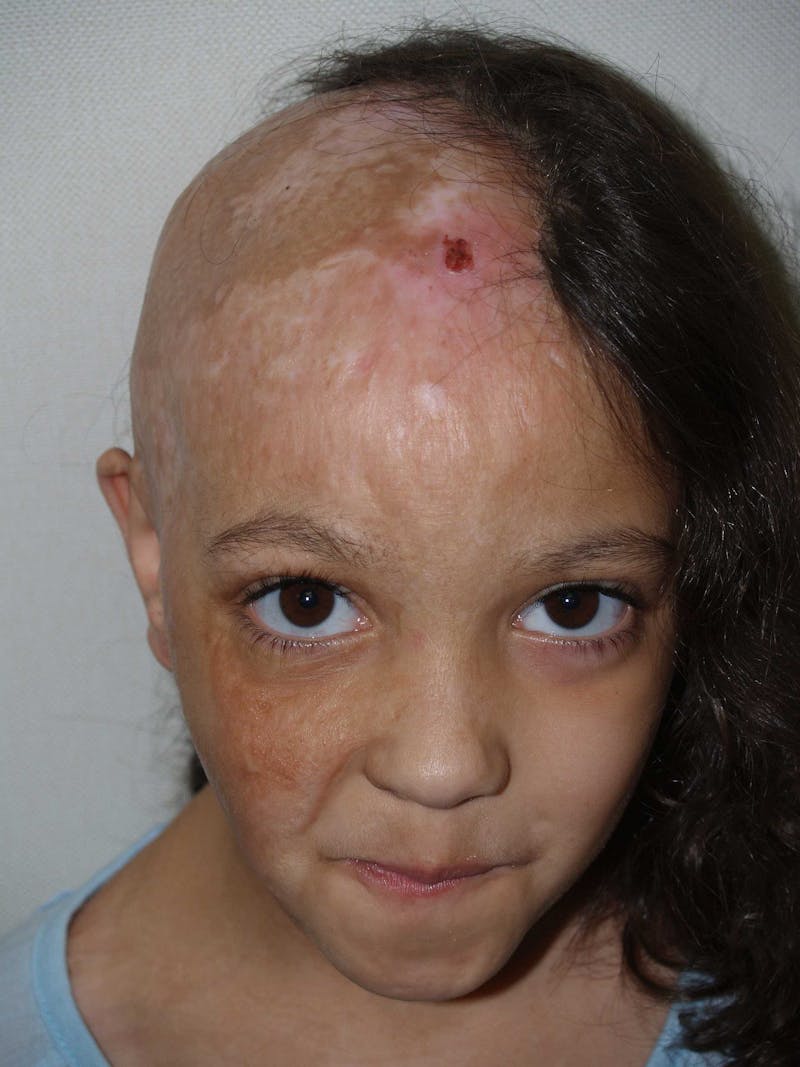 Special Cases Before & After Gallery - Patient 220993 - Image 1