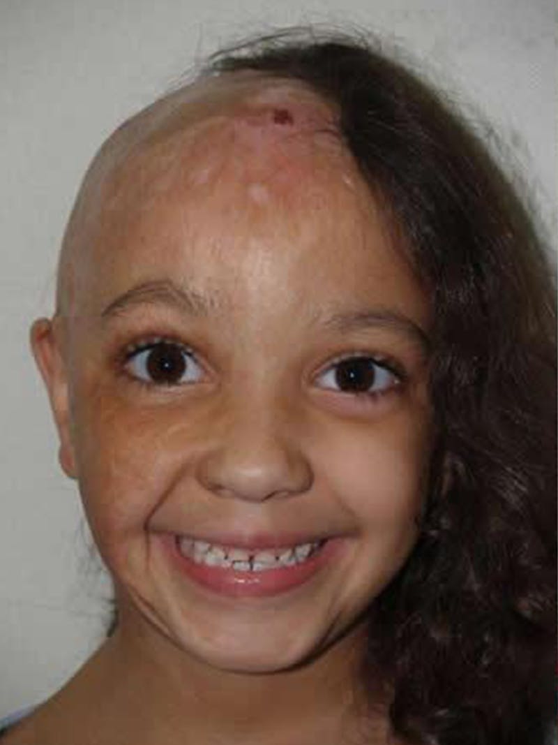 Special Cases Before & After Gallery - Patient 220993 - Image 2