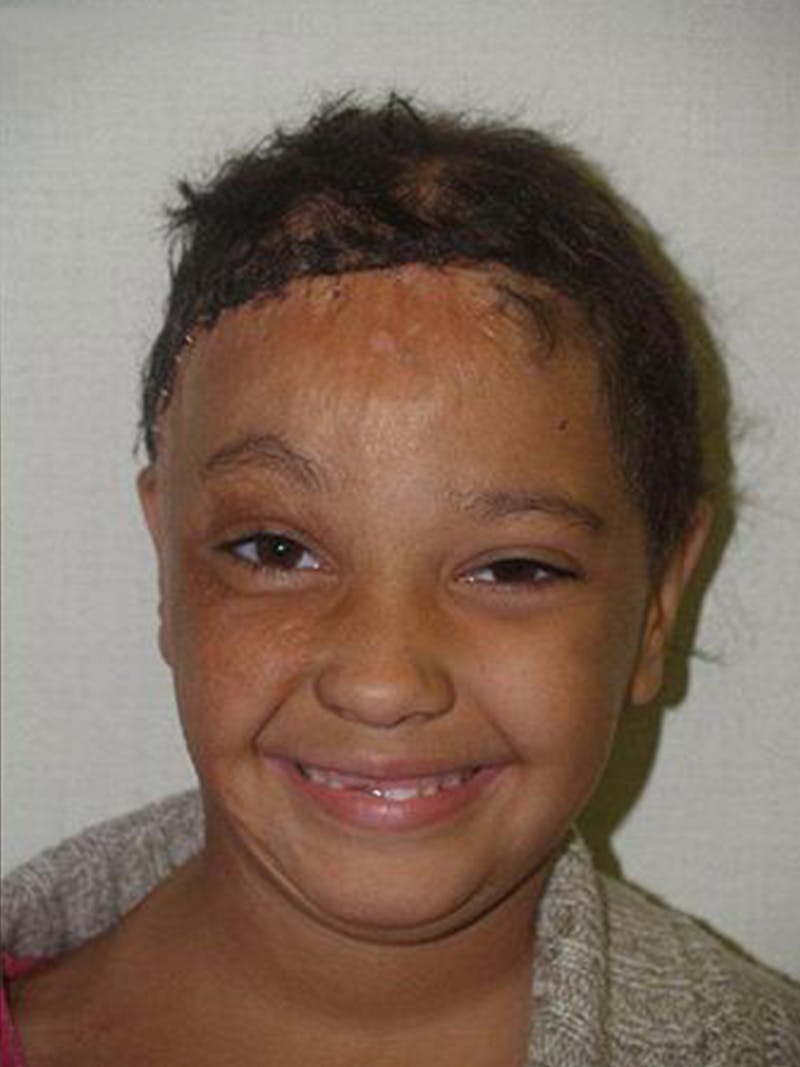 Special Cases Before & After Gallery - Patient 220993 - Image 4