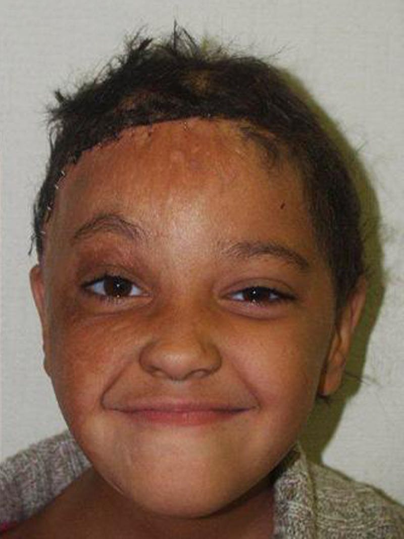 Special Cases Before & After Gallery - Patient 220993 - Image 5