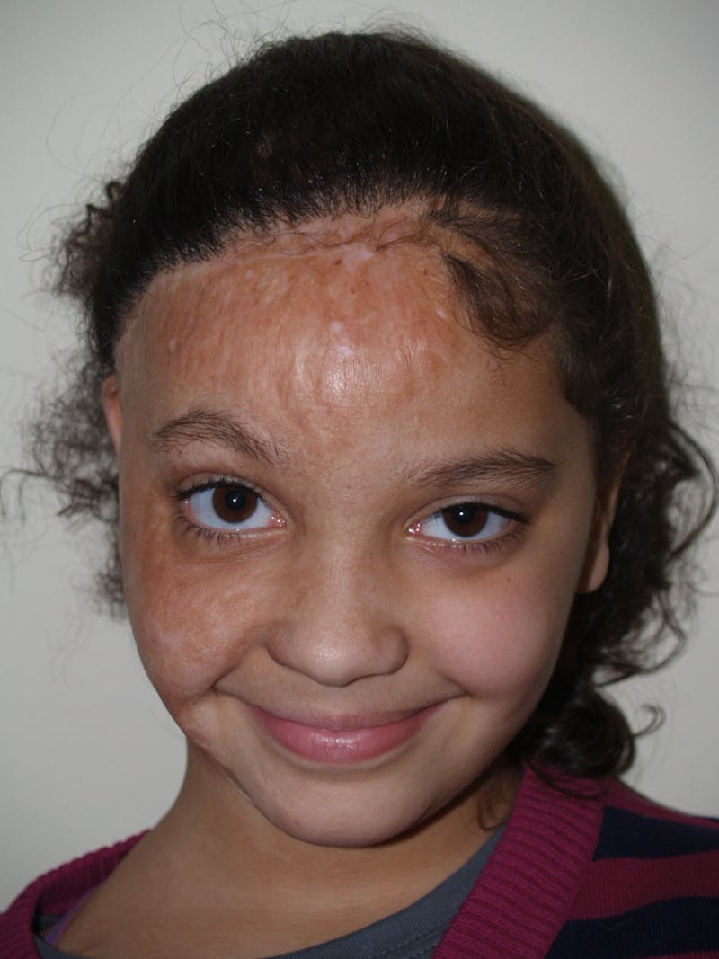 Special Cases Before & After Gallery - Patient 220993 - Image 6