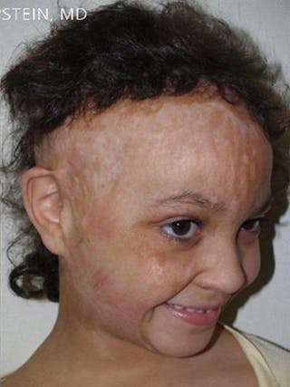 Special Cases Before & After Gallery - Patient 125687 - Image 4