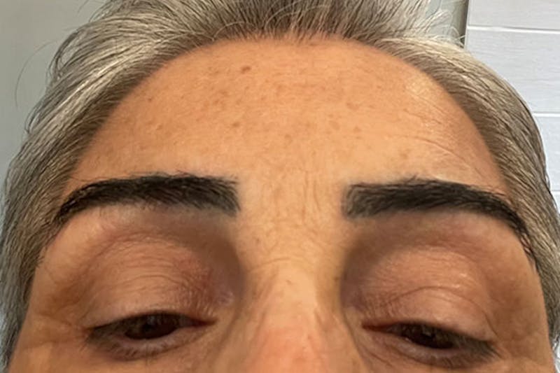 Special Cases Before & After Gallery - Patient 154739 - Image 4