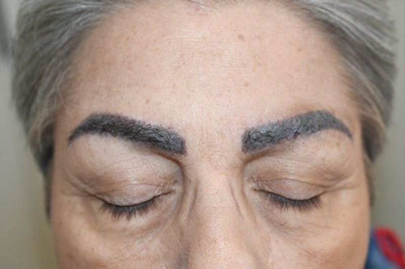 Special Cases Before & After Gallery - Patient 154739 - Image 1