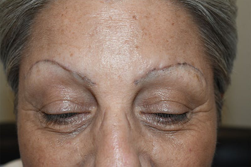Special Cases Before & After Gallery - Patient 649356 - Image 3
