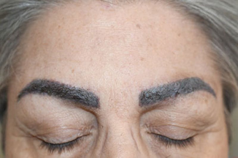 Special Cases Before & After Gallery - Patient 217016 - Image 1