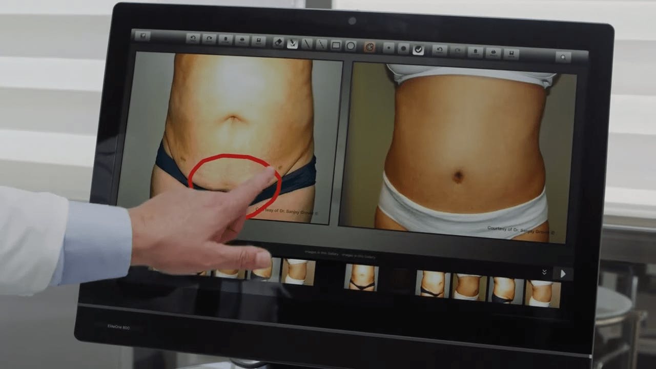 TouchMD video