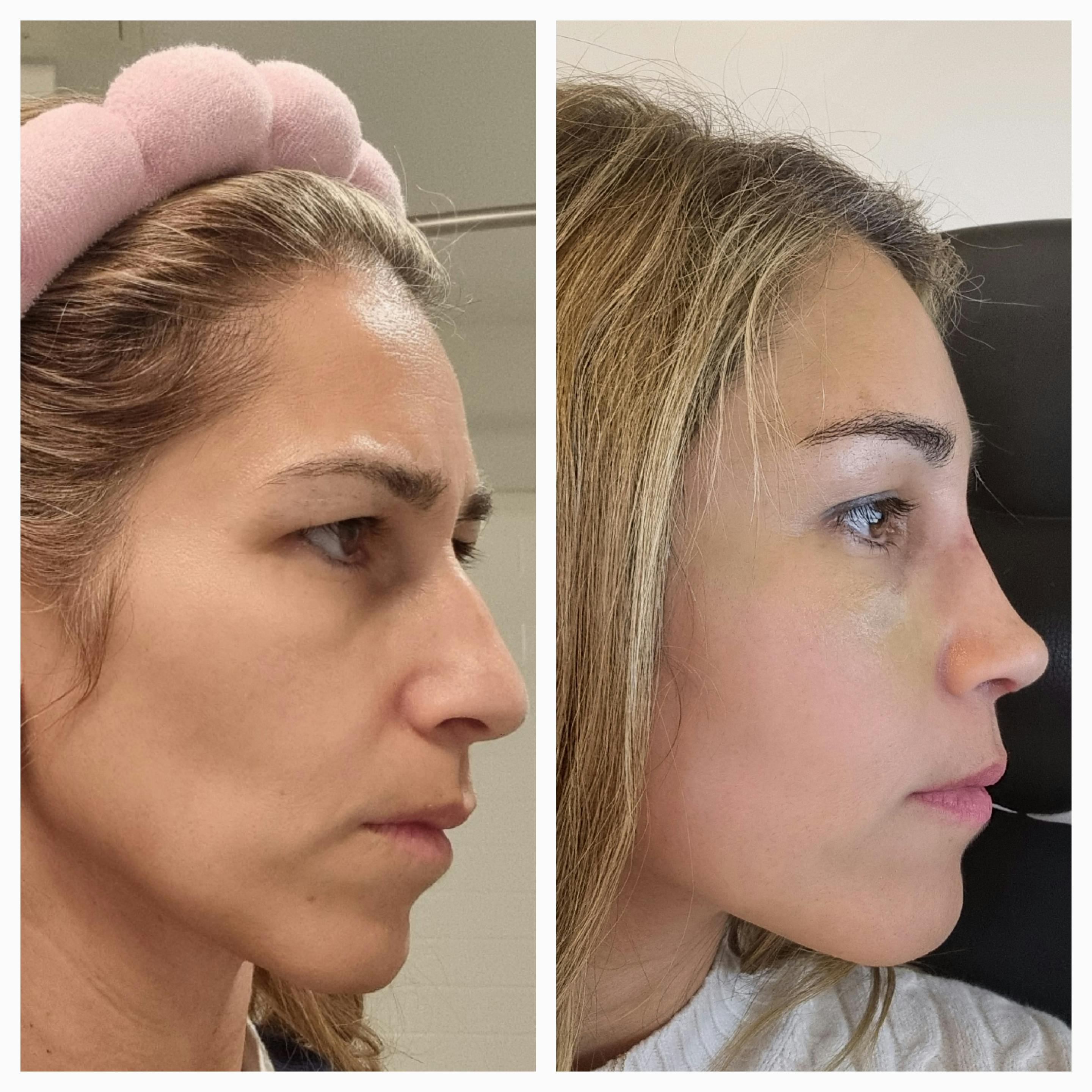 procedure